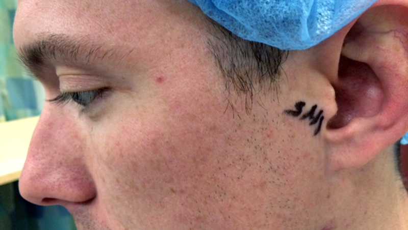 Illustration for article titled My Cyborg Ear: How a Surgeon and Titanium Cured My Lifelong Deafness